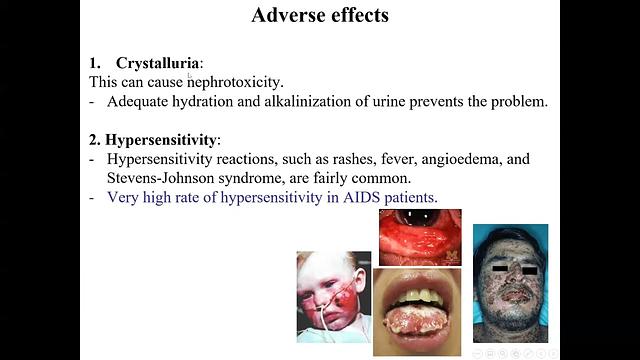 Folate Antagonists-Sulfonamides, Trimethoprim