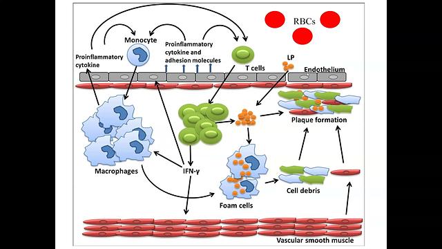 HTN7-Complications 2021