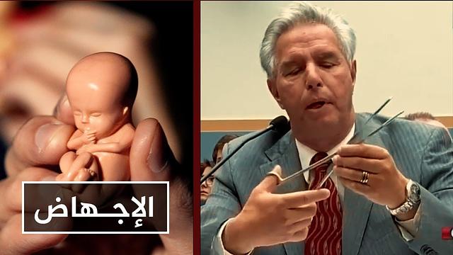 طبيب أمريكي يشرح كيف تتم عملية الإجهاض .. أجرى 1200 عملية سابقًا!!!